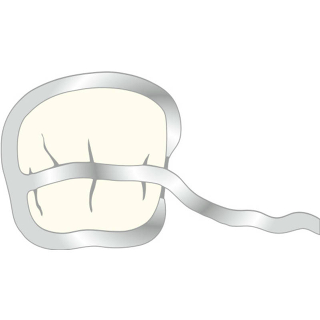 Scheu T-Klammer 0,9 mm, 10 stk