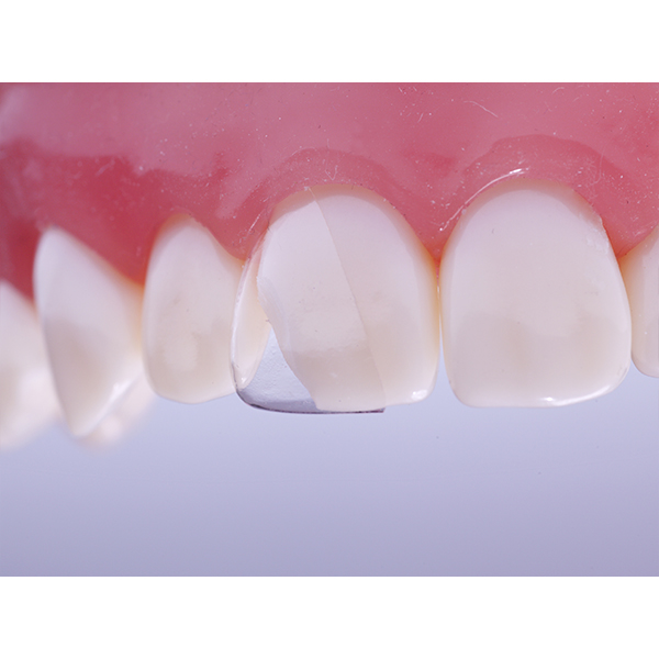 Directa CoForm nr. 11 mesial, 4 x 2 stk.